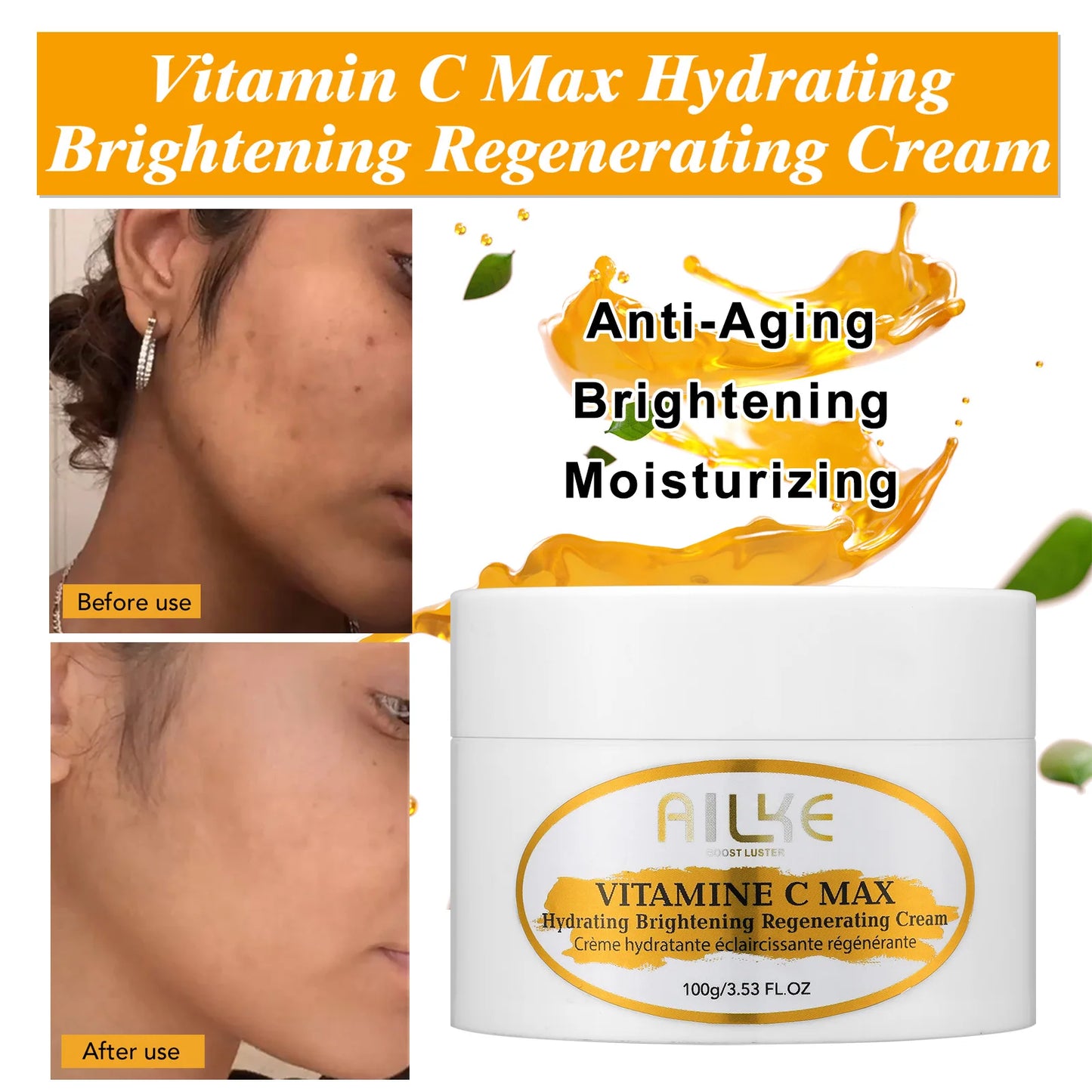 KYLIEFIT Vitamin C Whitening Serum For Dark Spot Reduction