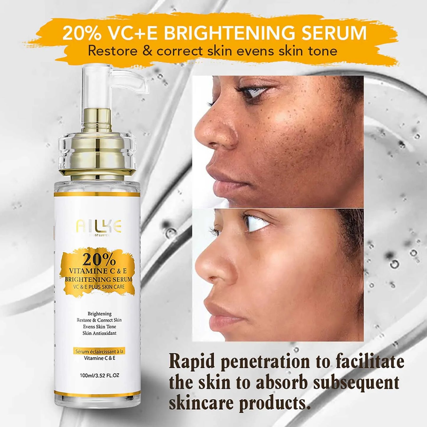 KYLIEFIT Vitamin C Whitening Serum For Dark Spot Reduction